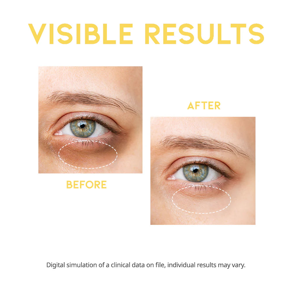 VC+ Dark circle eye serum gift