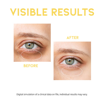 VC+ Dark circle eye serum gift